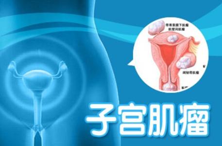 呼和浩特子宫肌瘤的症状