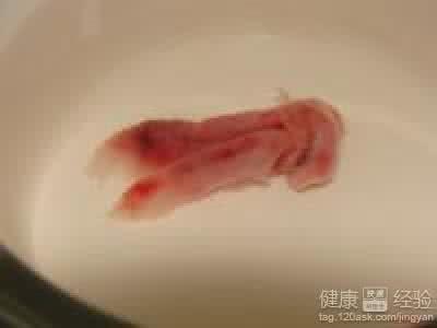呼和浩特怀孕多久可以做药流
