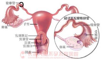 迟迟不孕 缘起输卵管炎