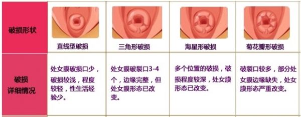 处女膜