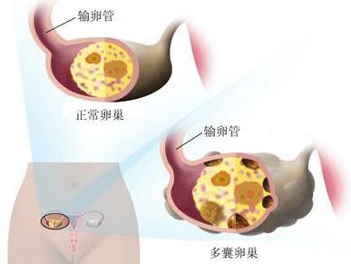 临床表现