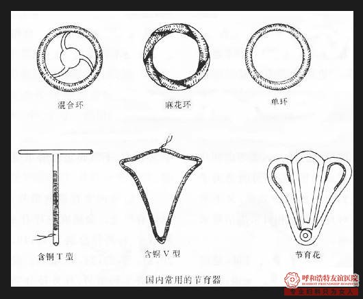 呼和浩特女性上环不能忽视的事项