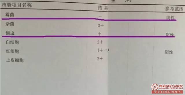如何读懂医院白带常规检查单