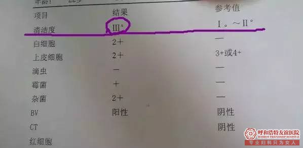 如何读懂医院白带常规检查单