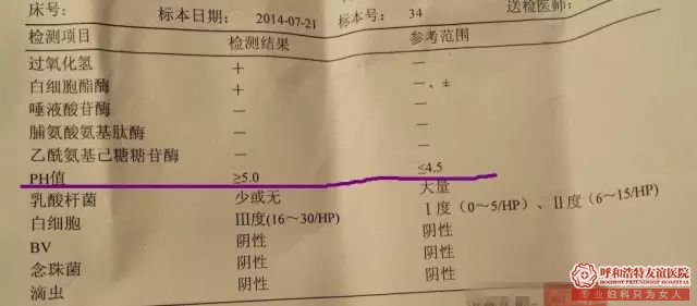 如何读懂医院白带常规检查单