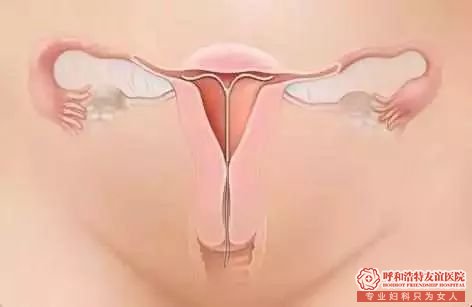 呼市女性取环再小也是手术,不注意这些可不行!