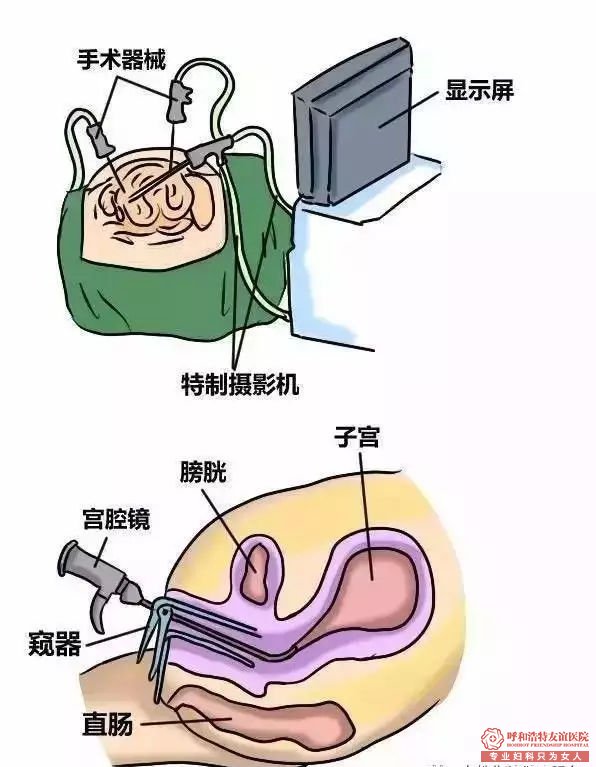 呼市妇科体检哪里好？妇科体检项目，你该怎么选？ 