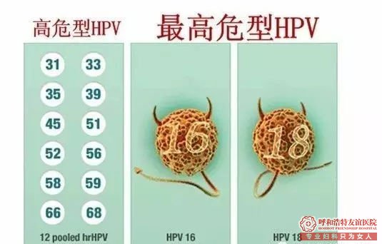 呼市妇科体检哪里好？妇科体检项目，你该怎么选？ 