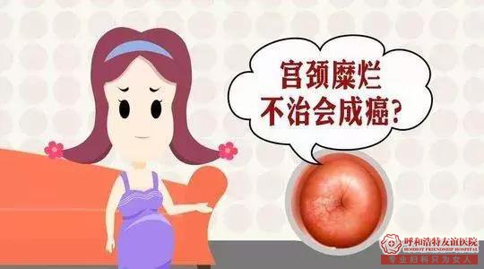 呼市定期妇检能有效预防宫颈疾病