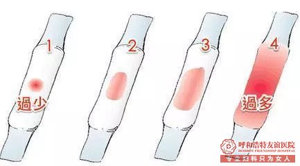 呼市妇科【科普】月经量少，是否应该置若罔闻？ 