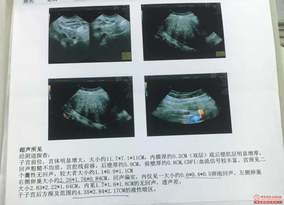呼市妇科医院医生好吗?幸遇丛医生 如获新生